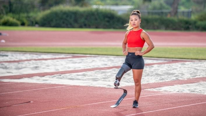 Aaron Holm walking wearing bilateral Genium knees