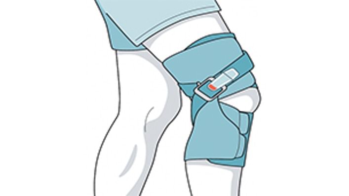 Treatment with the Agilium Vantage