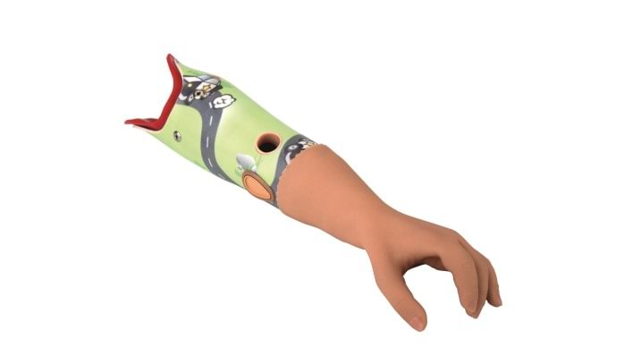 Pediatric prosthetic arm with creative sciocx design
