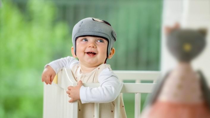 Baby with MyCRO Band orthotic helmet - Ottobock